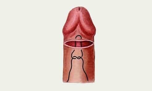 penis başı